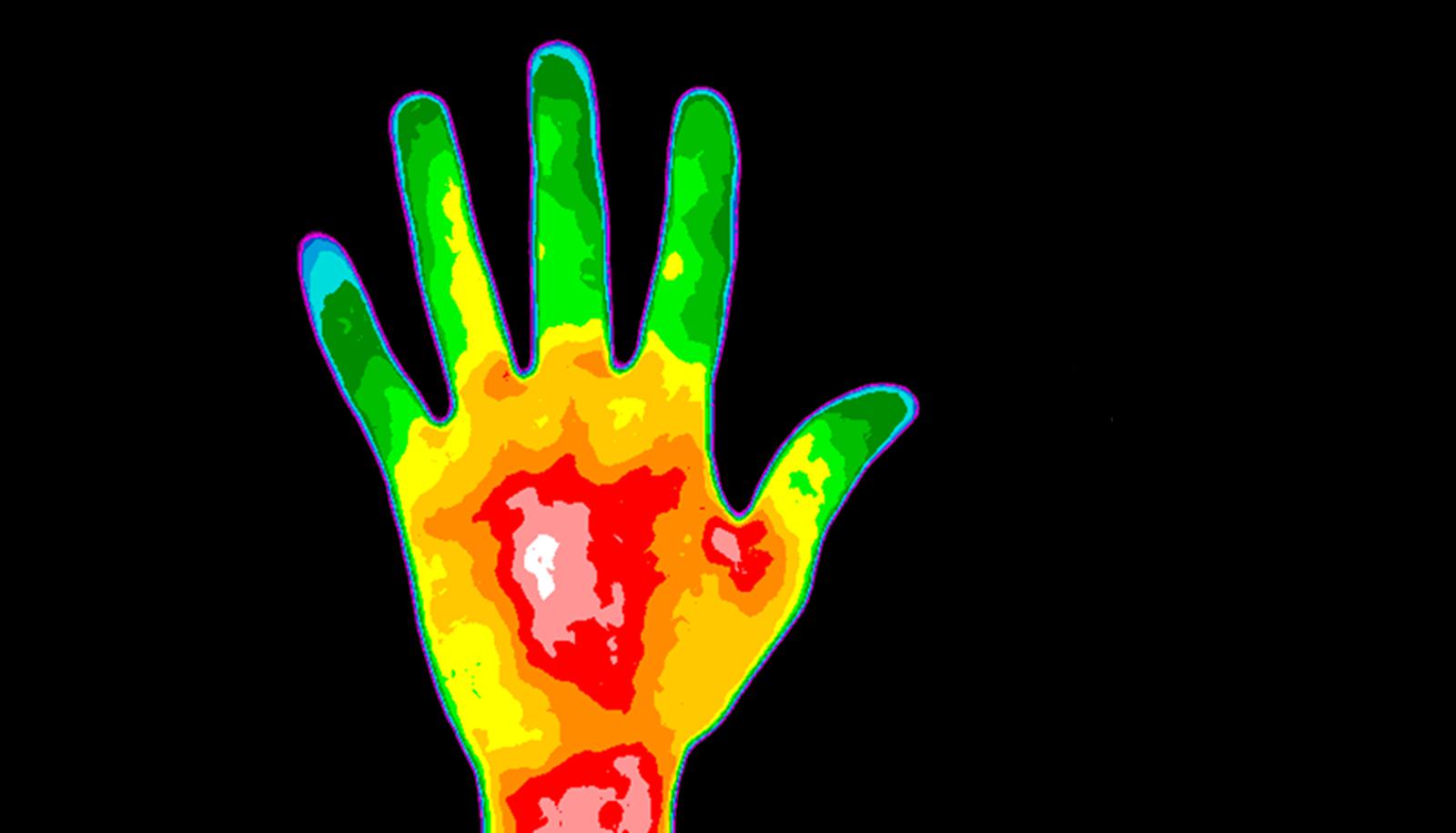 thermographic image of a hand