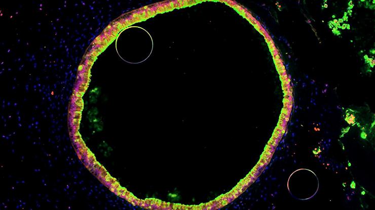 human intestinal organoid