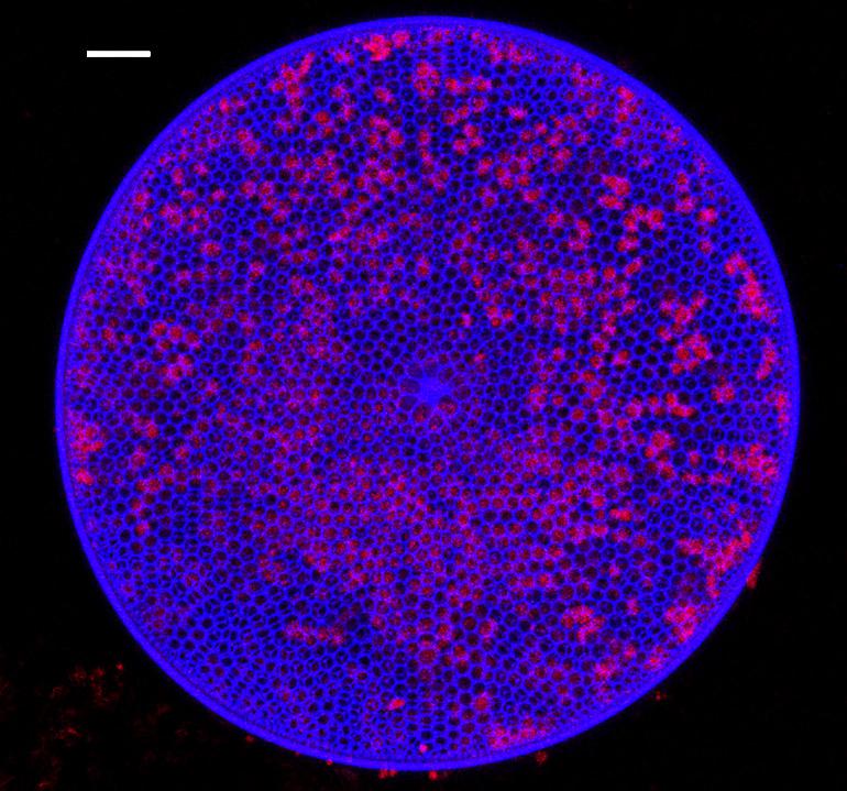 Diatom cell from the Gulf of Mexico (diatoms concept)