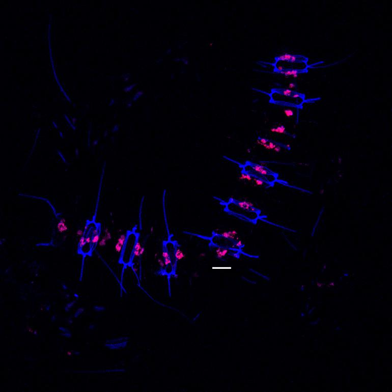 a chain of individual diatom cells stained with a fluorescent dye 