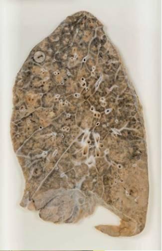 muyintes2011_article_085_01_02