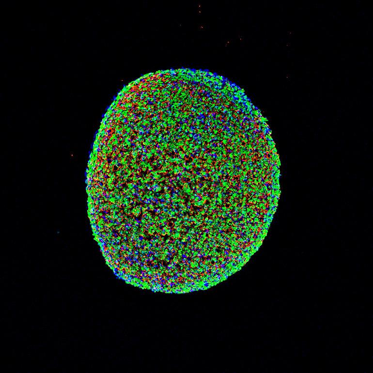 muscle cross section