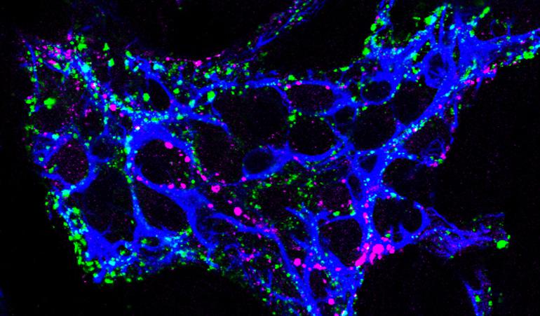 enteric glia - intestinal inflammation