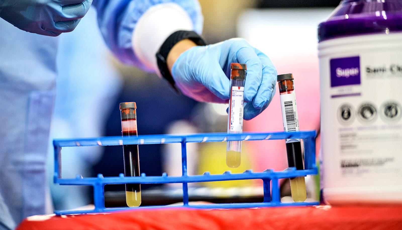 A researcher lifts a vial from a holder