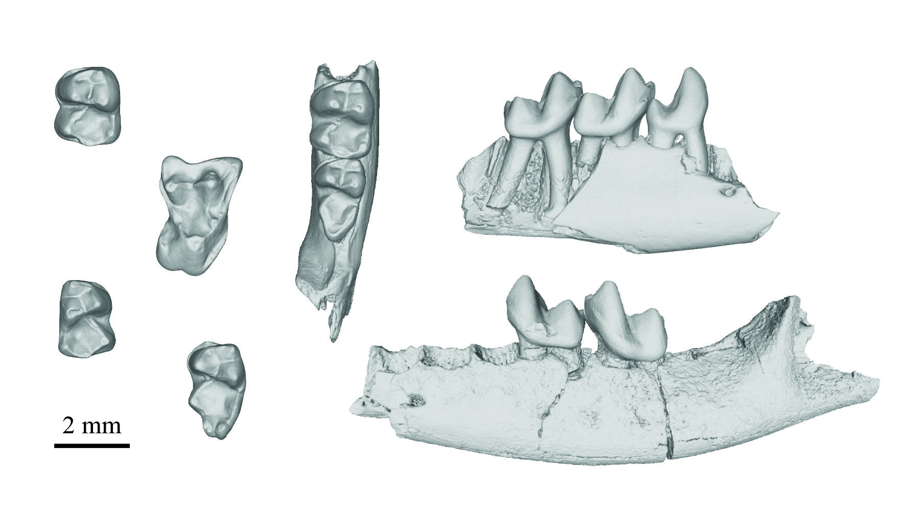 Several teeth, including some connected to jaw bones