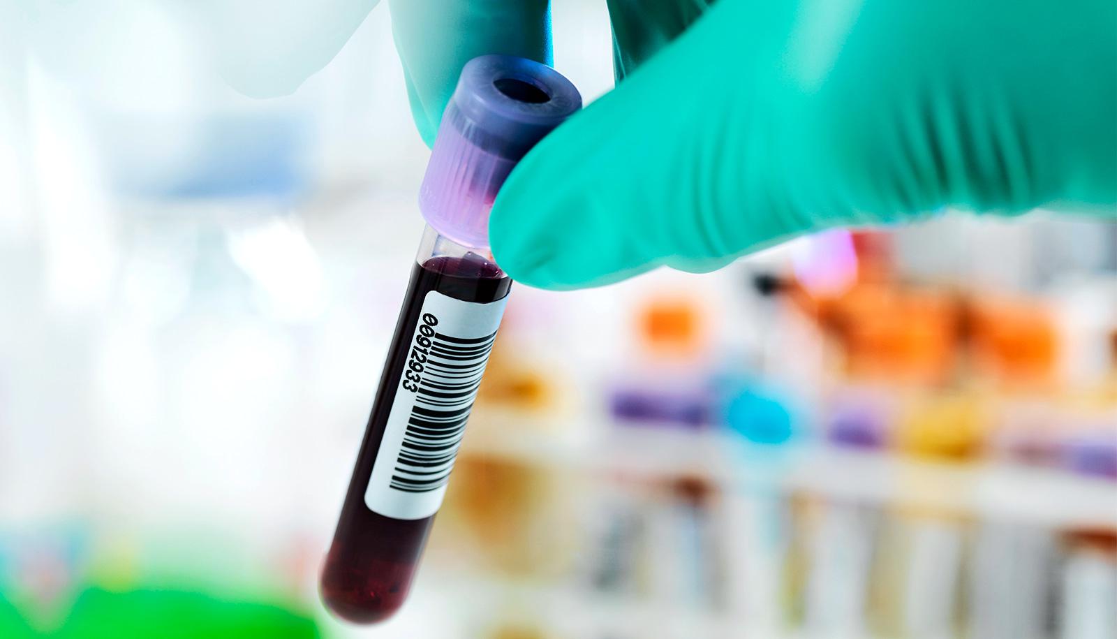 A health worker wearing green gloves picks up a blood test vial