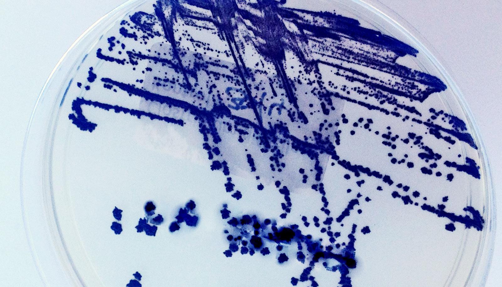 streaks of navy blue cell culture cross a clear petri dish