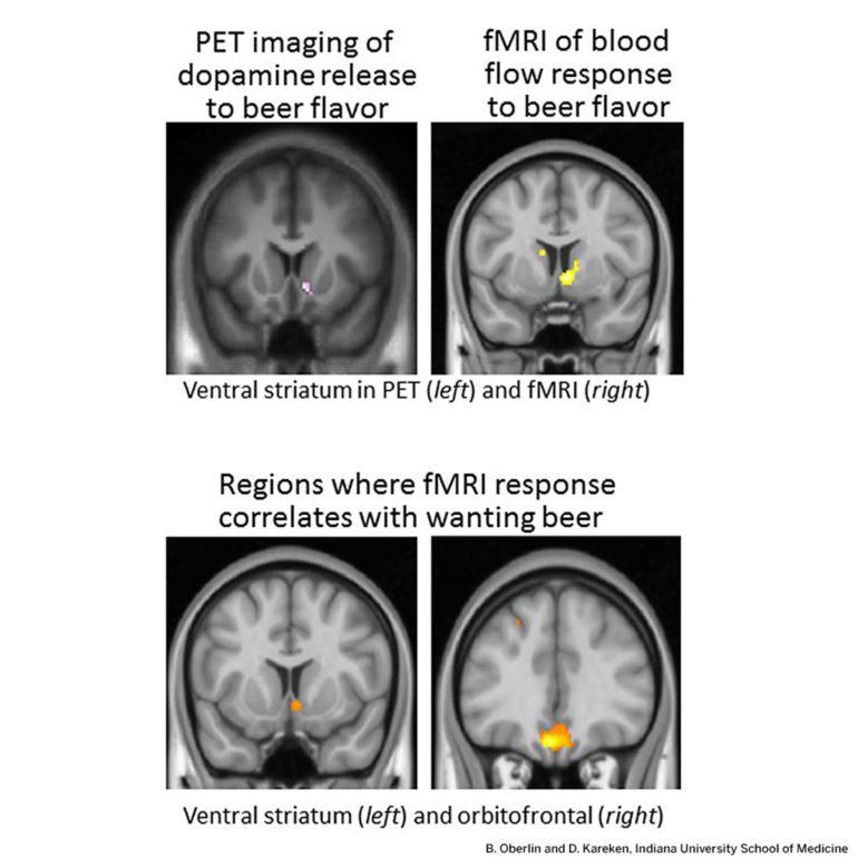 brain scans - beer flavor