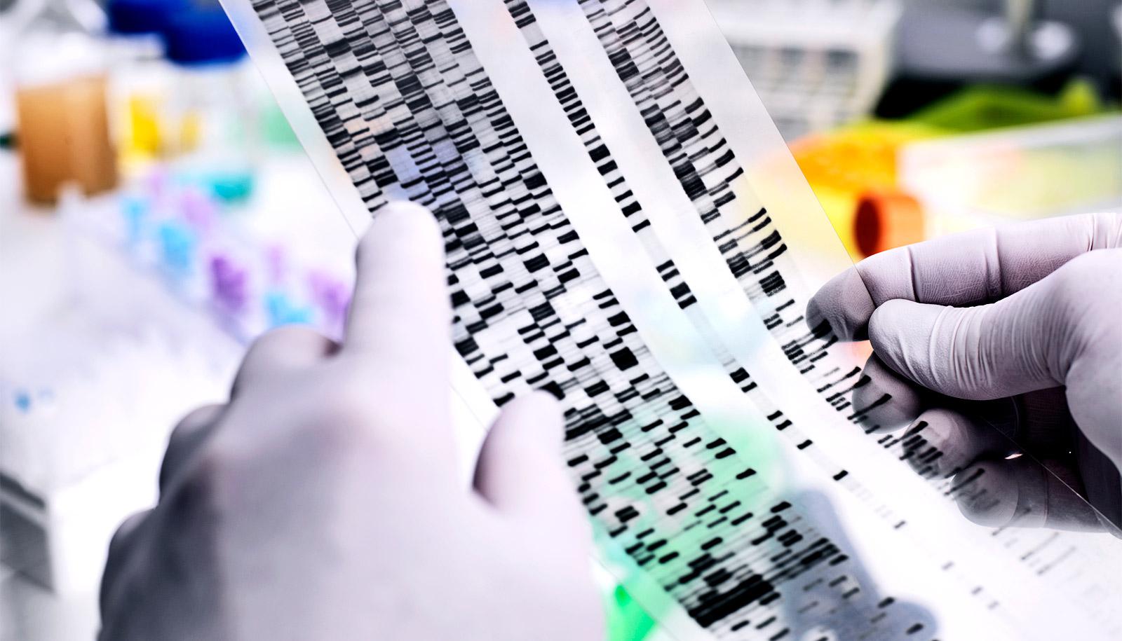 genetic makeup readout (Down syndrome concept)